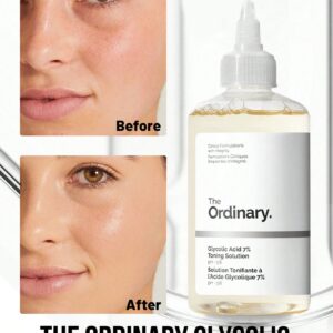 The Ordinary محلول حمض الجليكوليك 7% مقشر للبشرة يحسن الملمس ويزيل الخلايا الميتة بقطارة خفيف ومنعش